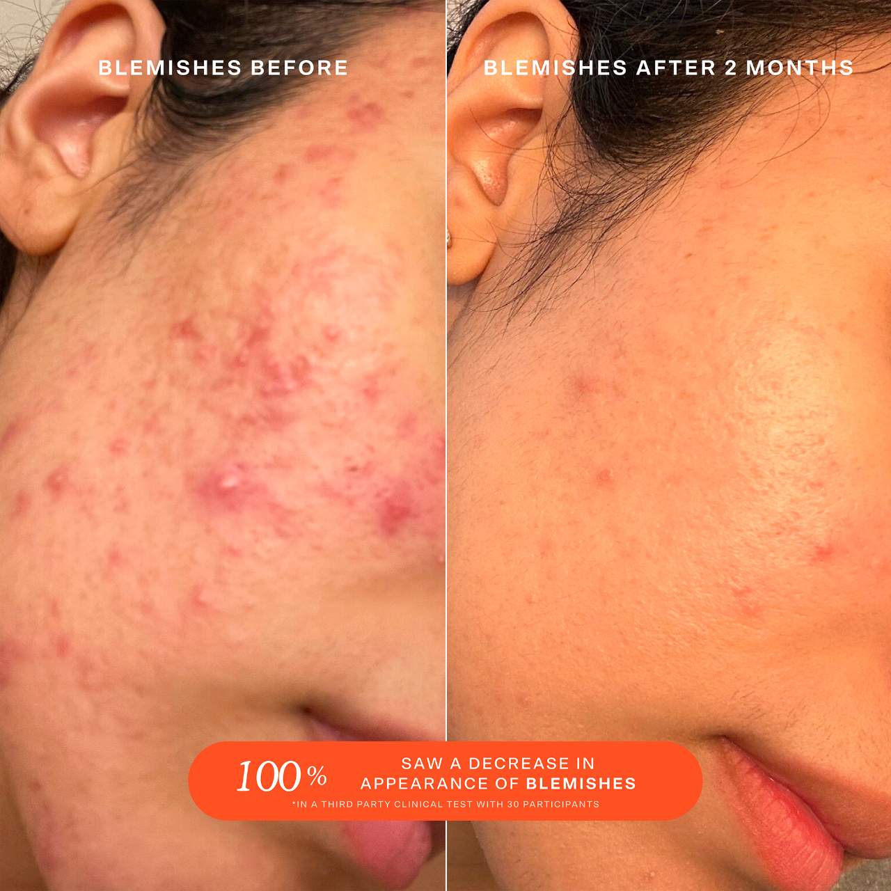 SOS Daily Rescue Facial Spray with Hypochlorous Acid