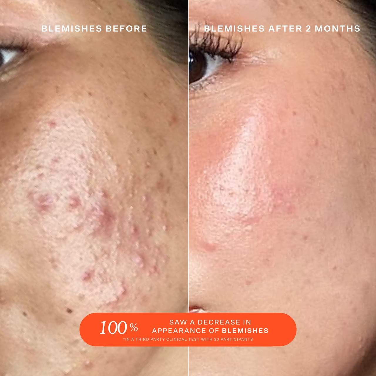 SOS Daily Rescue Facial Spray with Hypochlorous Acid