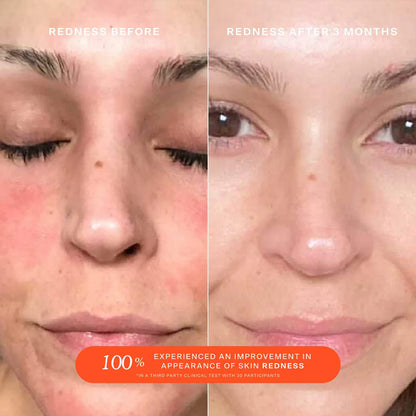 SOS Daily Rescue Facial Spray with Hypochlorous Acid