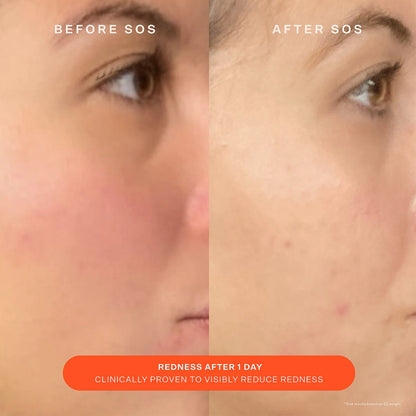 PRE ORDER-SOS Daily Skin Barrier Redness Recovery Moisturizer