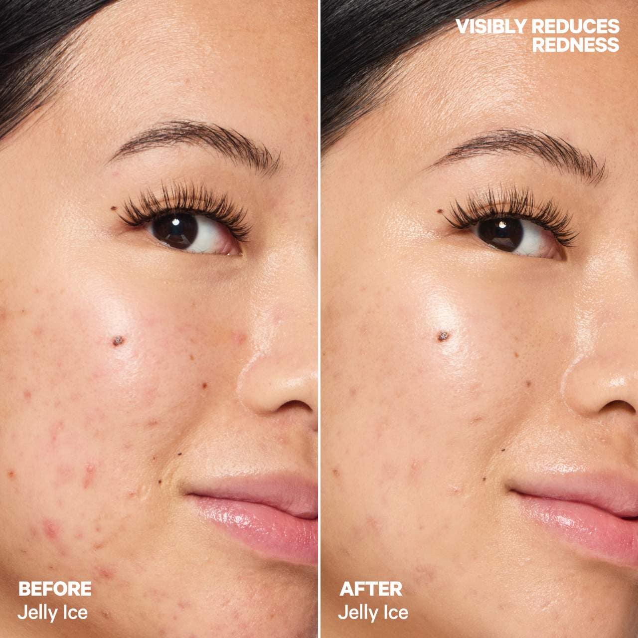 PRE ORDER-Cooling Water Jelly Ice Soothing Serum Stick with Niacinamide