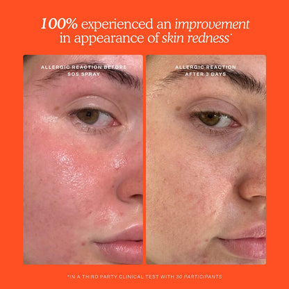 PRE ORDER-Mini SOS Skincare Bestsellers Set